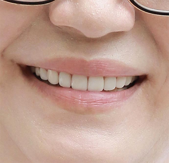 MINISH Dental Hospital No1 English Dentist in Seoul Korea Dental