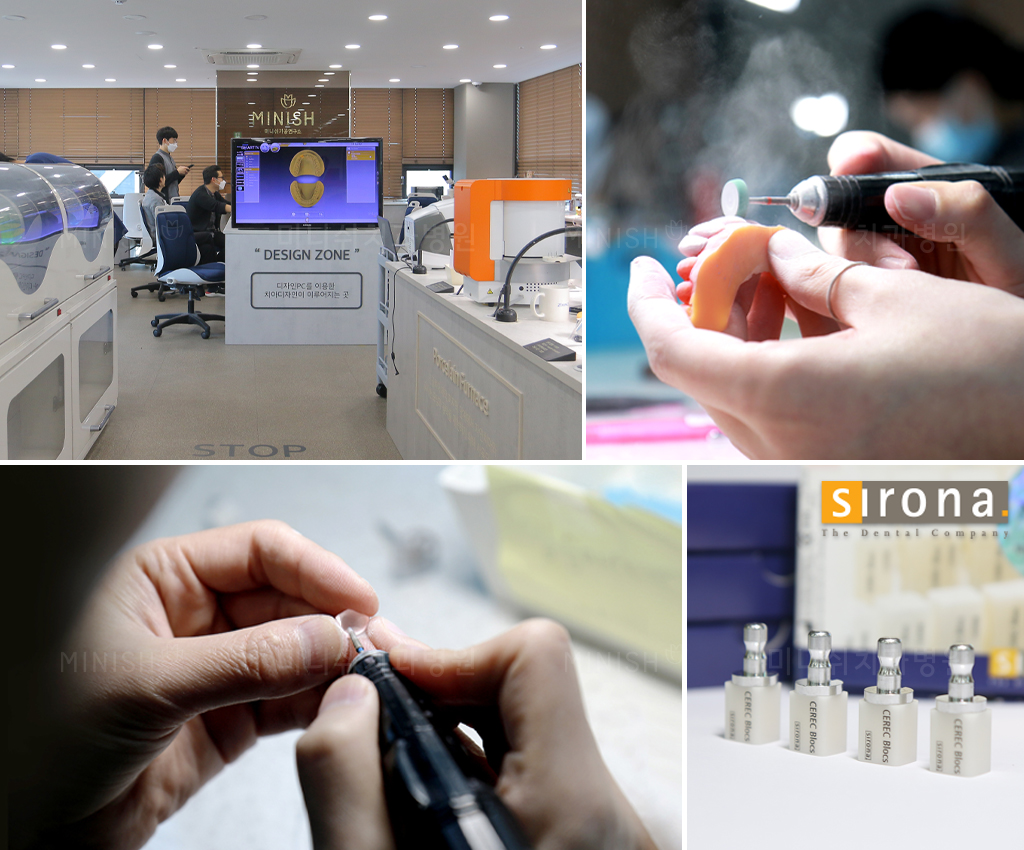 Veneers in Korea Teeth Shaving Methods and Benefits