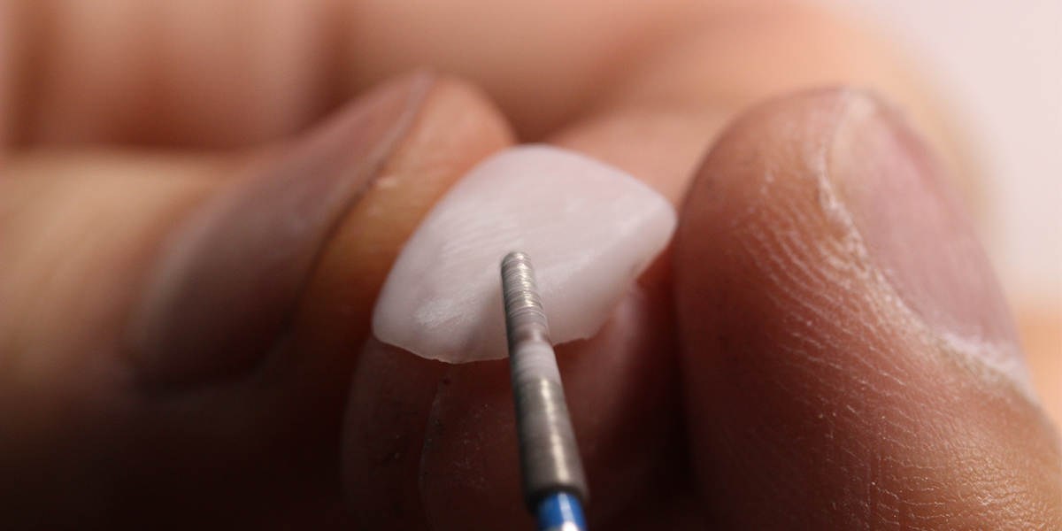 What Minimizes Veneer Teeth Shaving
