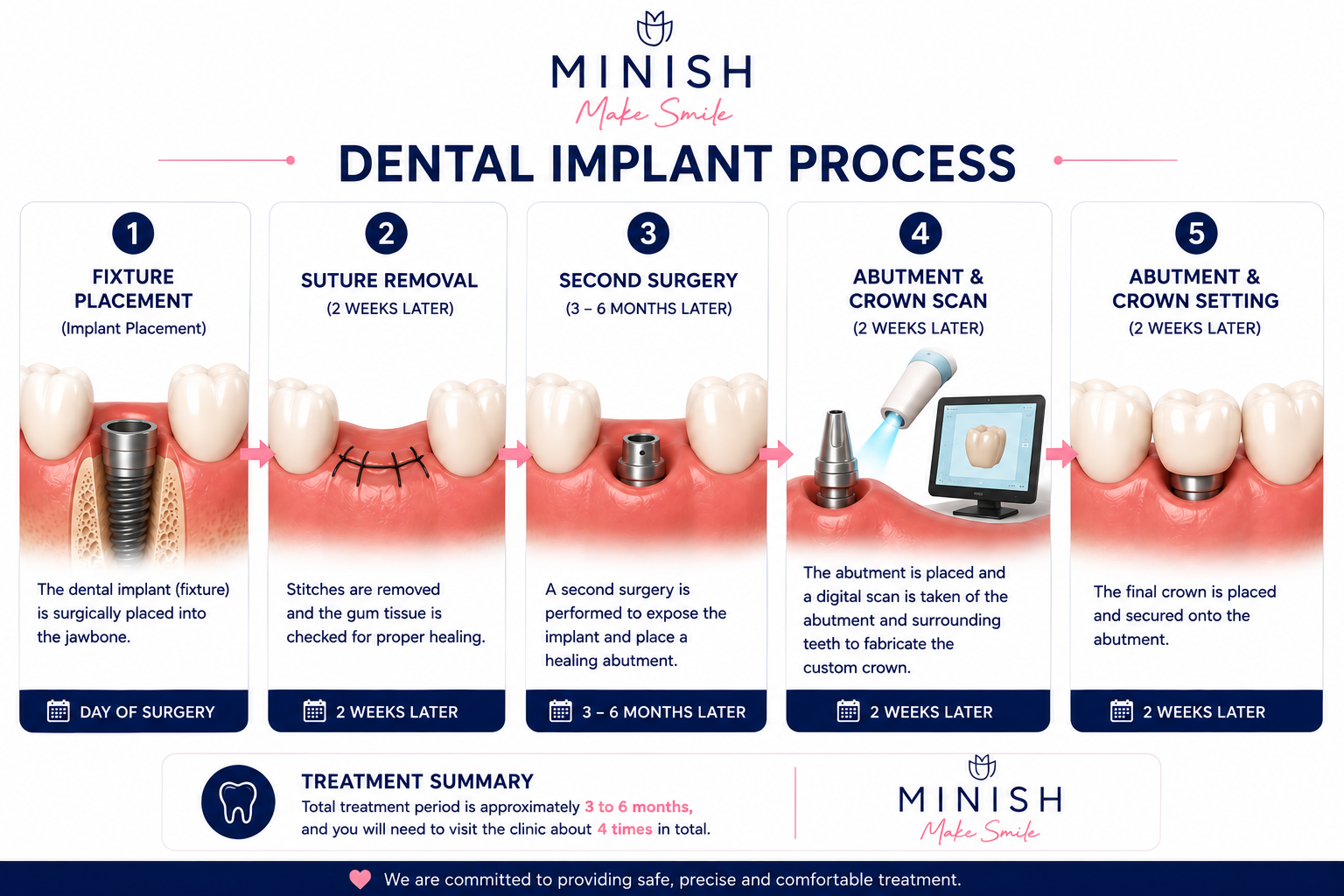 dental implants in korea at MINISH dental hospital clinic in seoul